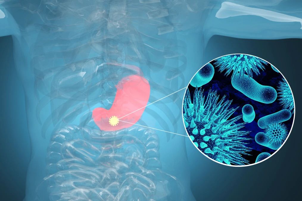 ���������CA72-4����θ�����㻹������